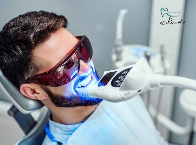 متخصص بلیچینگ دندان در شیراز